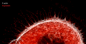 SARS-CoV-2 hijacks the transport system and skeleton of host cells