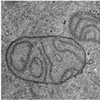 Cellular “power plants” control inflammation
