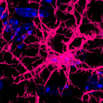 Anti-Aging fürs Gehirn? Wichtiger Signalweg bei der Hirnalterung identifiziert