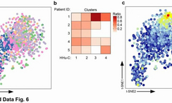 Scientists create new map of brain's immune system