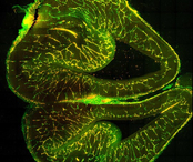 Brothers in arms: the brain and its blood vessels