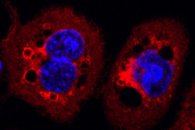 Bacterial protein impairs important cellular processes