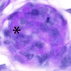 Epigenetischer Regulator von Gennetzwerken aus Zilien auch wichtig in zilienlosen Zellen